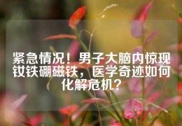 緊急情況！男子大腦內驚現釹鐵硼磁鐵，醫學奇跡如何化解危機？